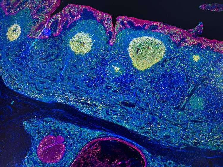 Irccs Pascale Napoli, 'mappa Gps' delle cellule rivoluziona l'immunoterapia