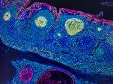 Irccs Pascale Napoli, 'mappa Gps' delle cellule rivoluziona l'immunoterapia