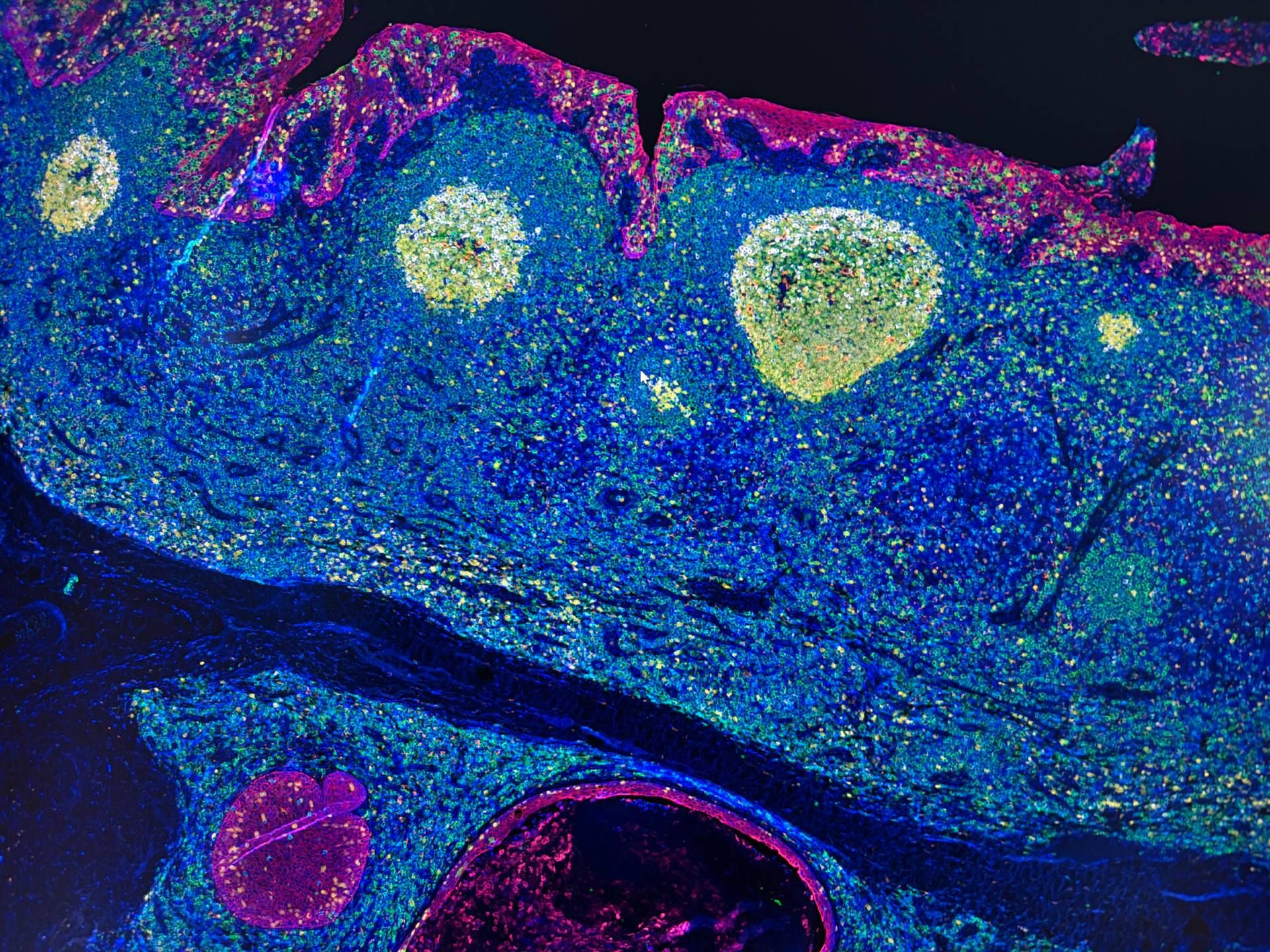 Irccs Pascale Napoli, 'mappa Gps' delle cellule rivoluziona l'immunoterapia