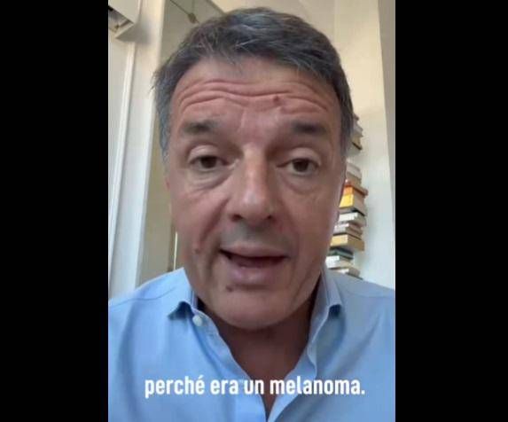 Renzi, il melanoma rimosso e l'appello: "Tolto in tempo, ma bisogna controllarsi"