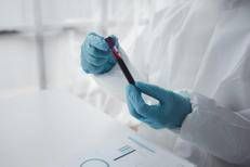 Provetta per analisi del sangue - ()