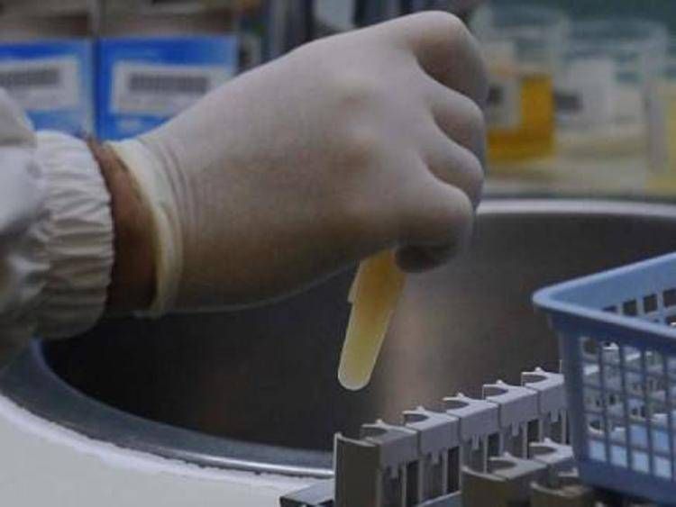 Esami di laboratorio (Fotogramma)