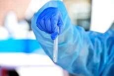 Virus in provetta - Afp