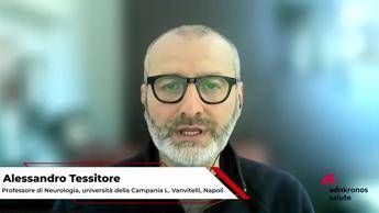 Farmaci: neurologo Tessitore 'fase trasformativa caratterizzata dalla ricerca di anticorpi'