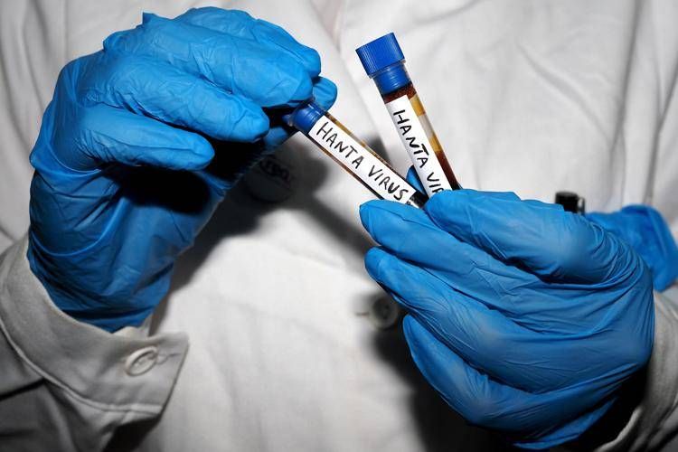 Provette positive Hantavirus (Fotogramma/Ipa)