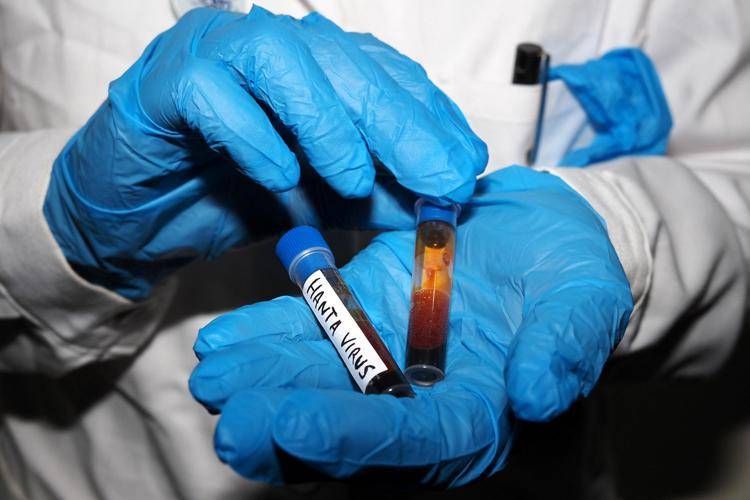 Provette per il test hantavirus - Fotogramma /Ipa