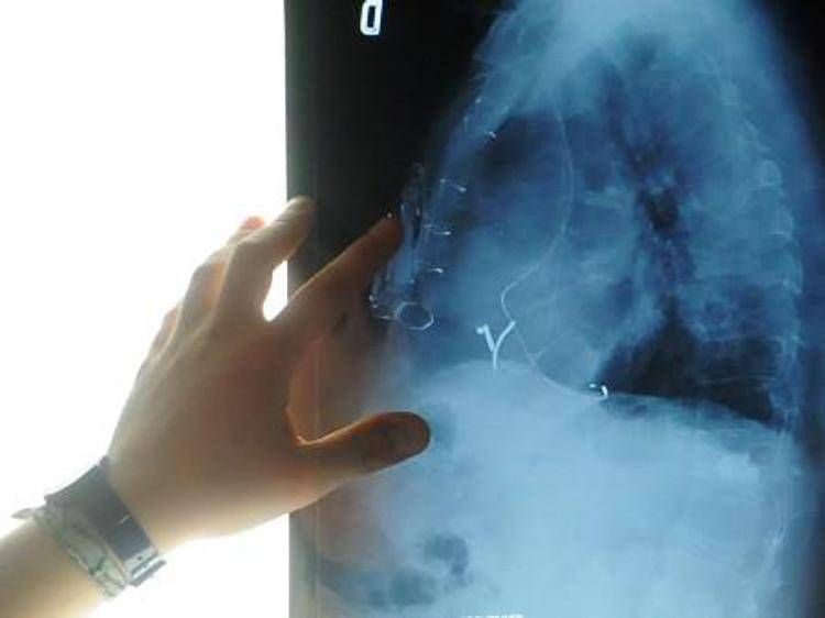 Radiografia - (Fotogramma)