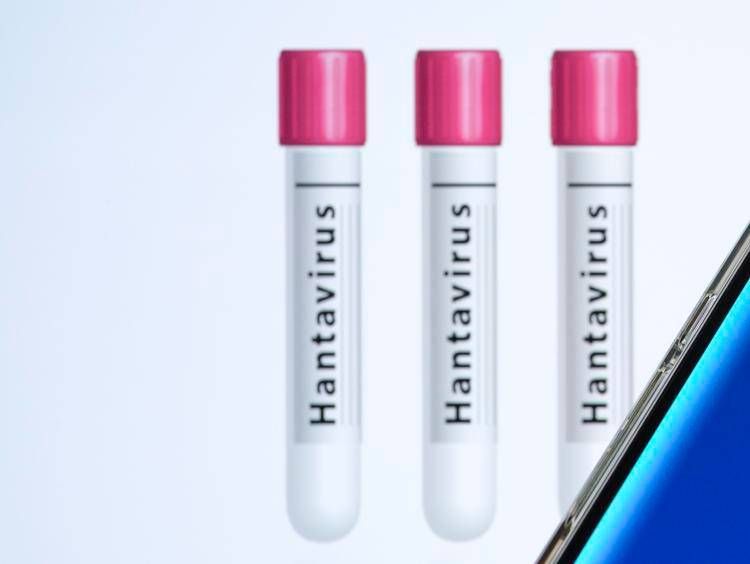 Provette con etichetta Hantavirus - (Ipa)