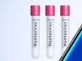 hantavirus8 ipa