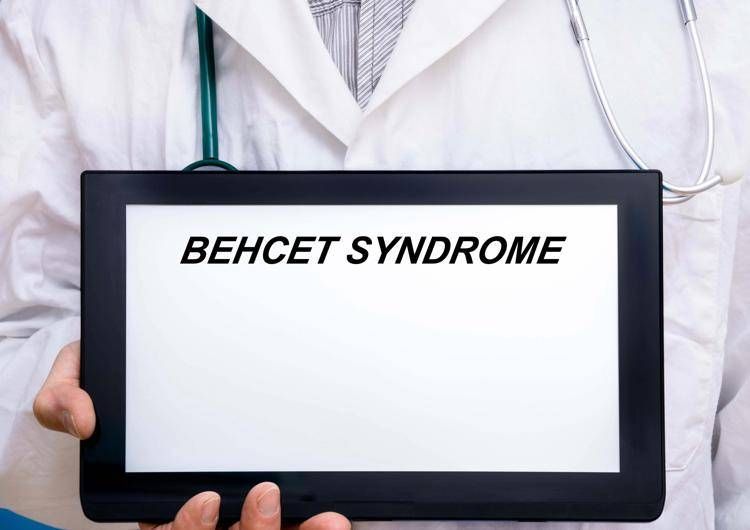 sindrome Behçet - Foto Adobe