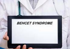 sindrome Behçet - Foto Adobe