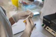 Laboratorio analisi - (Fotogramma)