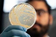 Il microbiologo Mohamed Sarhan esamina le colonie di lievito prelevate da un campione dello stomaco di Ötzi (foto Eurac Research - Andrea De Giovanni)