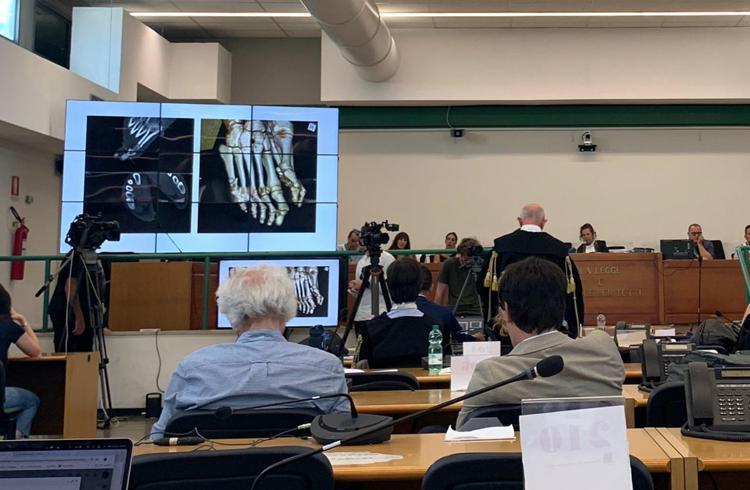 Le tac sul corpo di Giulio Regeni mostrate oggi in aula - Adnkronos
