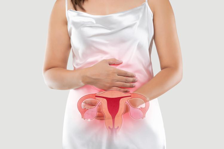 Carcinoma dell’endometrio - (foto di repertorio)