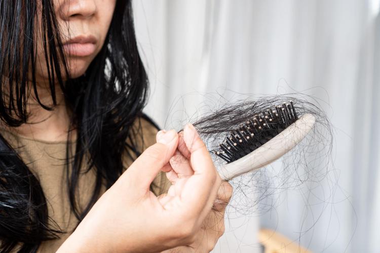 Caduta dei capelli - 

