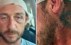 Angelo Ratti dopo l'aggressione omofoba - Biscotto della Fortuna /Instagram