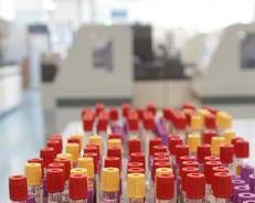 Un laboratorio  - (Fotogramma/Ipa)