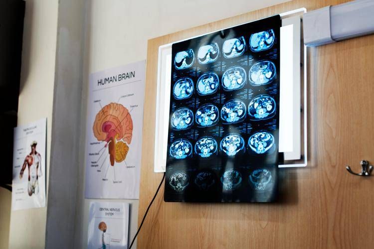Cervello ai raggi X - (Foto )