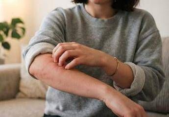 Malattia della pioggia, perché se ne parla: cos'è e sintomi