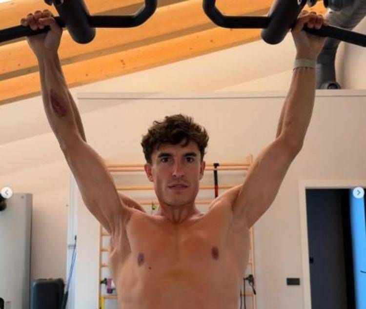 La spalla di Marquez - Instagram