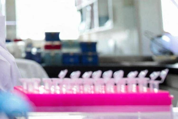 Analisi di laboratorio - (Fotogramma)