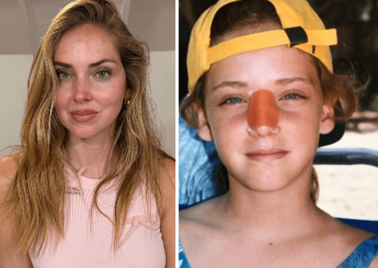 Chiara Ferragni - fotogramma/ipa