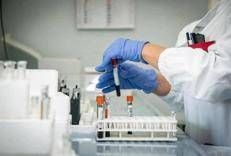 Laboratorio analisi - (Adnkronos)