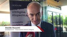 Salute: Rossetti (Aiv), 'associazione per accelerare riconoscimento nuove terapie vitiligine'