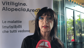 Cassia (Aipaf): "Con nuove terapie Ssn riconosca alopecia per sostenere i pazienti"