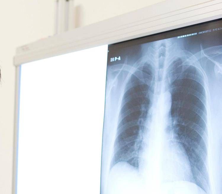 Radiografia torace  - (123Rf)