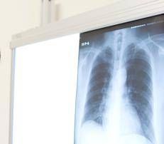 Radiografia torace  - (123Rf)