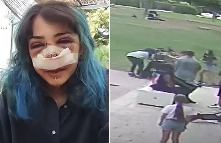 Picchiata al Parco Rossani, processo al via il 4 novembre: la 26enne ha pubblicato il video dell’aggressione
