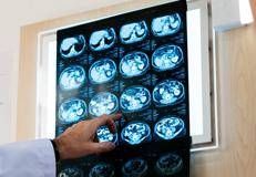 Radiografia - (Ipa)