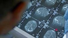 Fenilchetonuria, 'screening neonatale evita danni neurologici ma serve continuità assistenziale'