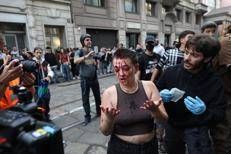 Milano, ragazza ferita al corteo 'Italia in Piazza' - Ipa