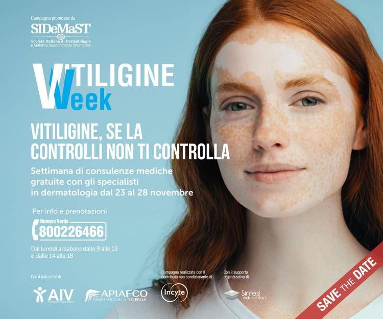Vitiligine week  - (Foto da sito Sidemast)