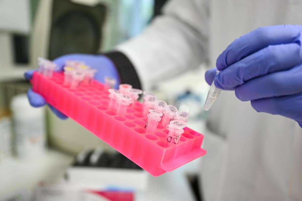 Risultato immagini per CORONAVIRUS PROVETTE