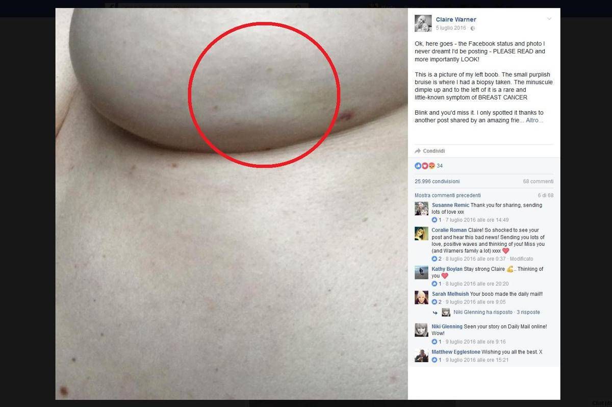 Il Post Virale Che Mostra Un Sintomo Sconosciuto Del Cancro Al Seno Il Post Virale