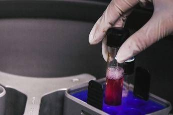 In 73 Paesi carenza farmaci contro Hiv, allarme Oms In 73 Paesi carenza farmaci contro Hiv, allarme Oms