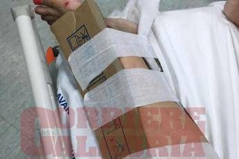 Mancano i gessi, cartoni per 'bloccare' fratture Mancano i gessi, cartoni per 'bloccare' fratture