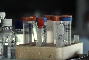 Hiv, ogni 2 minuti un adolescente contagiato Hiv, ogni 2 minuti un adolescente contagiato