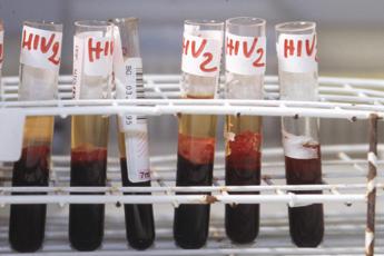 Aids, pg Cassazione: Nuovo processo per Talluto