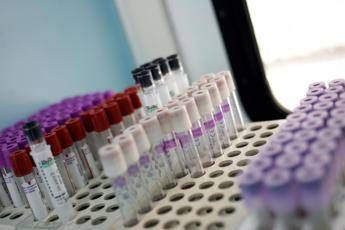 Leucemia linfatica cronica, ok Aifa a mix chemio-free per 24 mesi Leucemia linfatica cronica, ok Aifa a mix chemio-free per 24 mesi