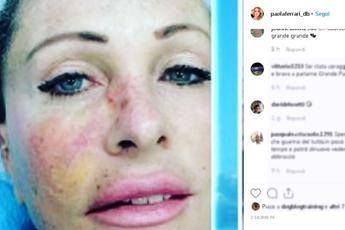 Paola Ferrari mostra carcinoma: Paola Ferrari mostra carcinoma: