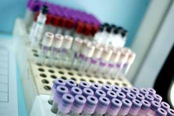 Coronavirus, Ieo Milano: Nel sangue cellule spia per evitare effetti mortali Coronavirus, Ieo Milano: Nel sangue cellule spia per evitare effetti mortali