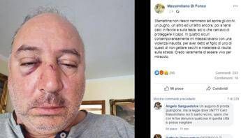 Rimprovera uomo che getta rifiuti, pestato consigliere comunale Rimprovera uomo che getta rifiuti, pestato consigliere comunale
