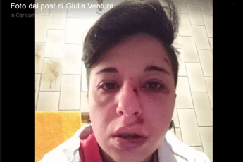 Pestata a Potenza perché lesbica, le foto choc Pestata a Potenza perché lesbica, le foto choc