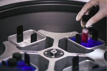 Coronavirus, oggi notificate infezioni di 10-11 giorni fa Coronavirus, oggi notificate infezioni di 10-11 giorni fa