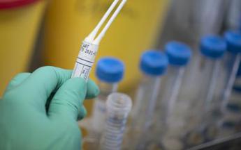 Coronavirus, Galli: Test del governo inadatto per riaprire il 4 maggio
